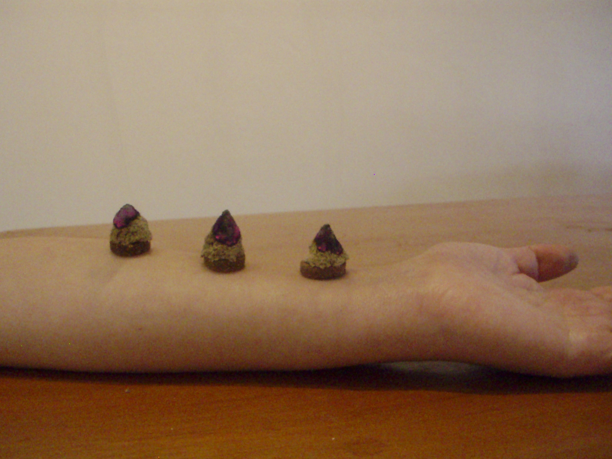 Moxibustion detail on forearm